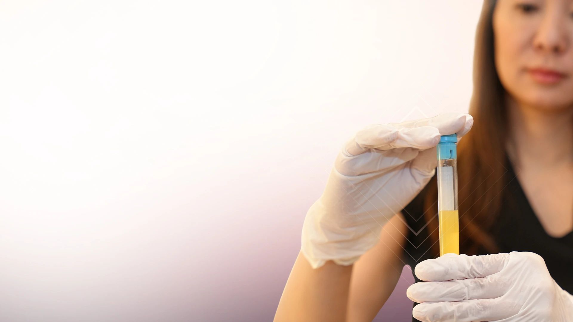 O-Shot (Orgasmic Shot) treatment at Toronto medical spa - PRP Injections to Support Intimate Wellness and Bladder Control...